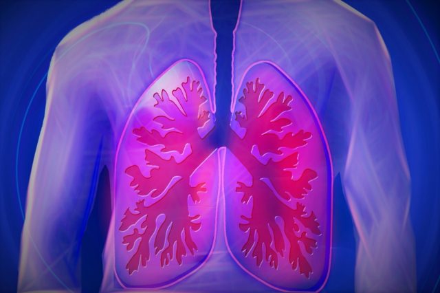 Psikoteknikoak: Pneumonia duten gaixoen eboluzio txarra iragarri nahian